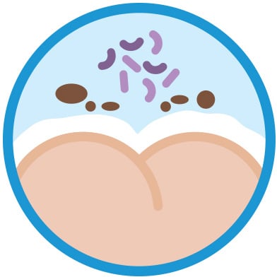 Protege la piel de tu bebé de las enzimas y las bacterias de la materia fecal